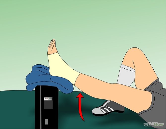 670px-Treat-an-Ankle-Sprain-Step-5.jpg