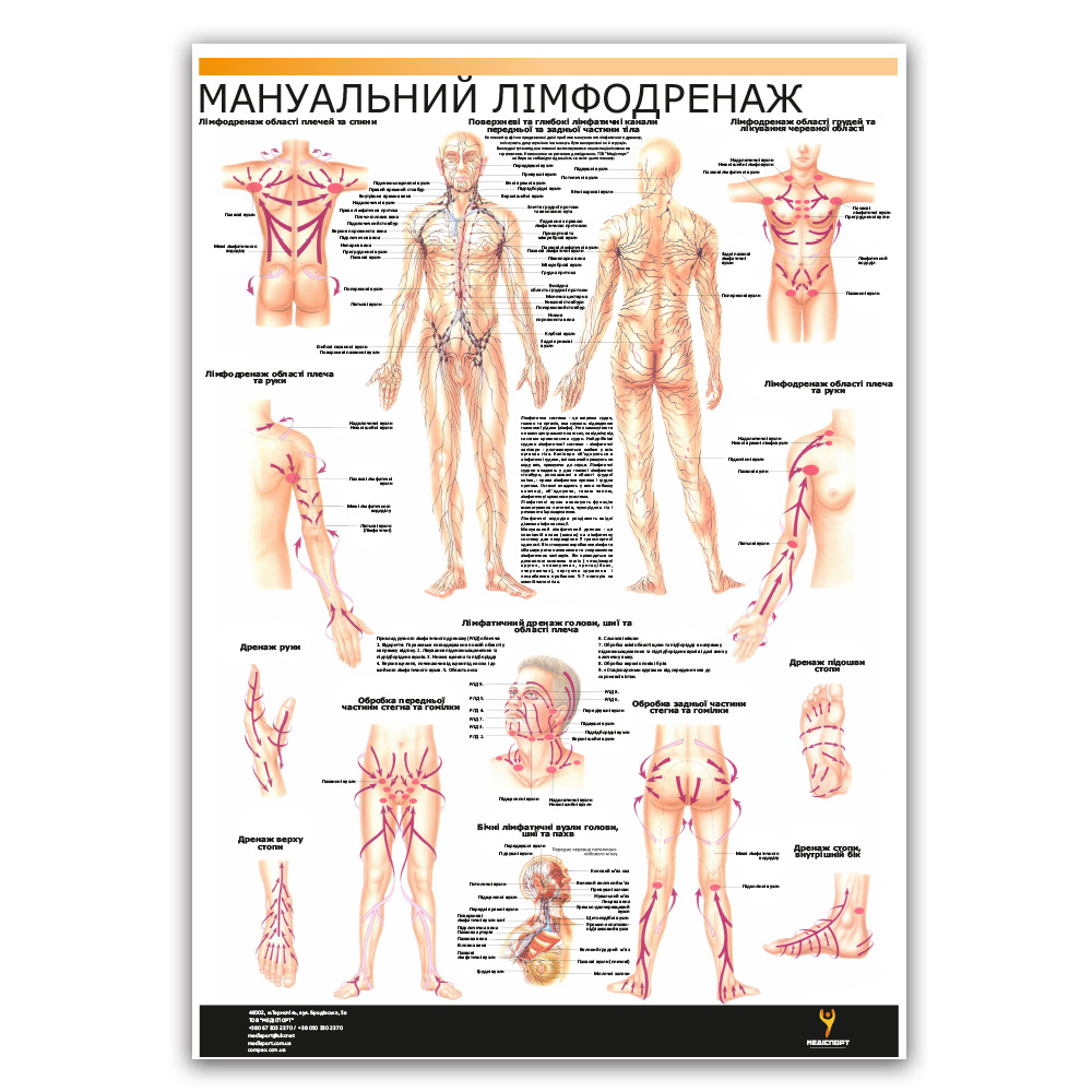 Плакат "Мануальний лімфодренаж" Медіспорт